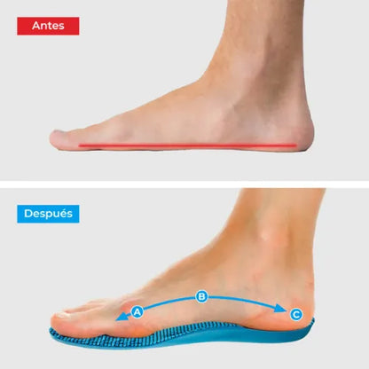 Plantillas ComfyFeet™ | Disfruta de días sin dolor